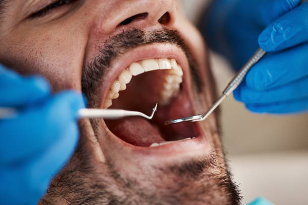 Best Emergency Cosmetic Dentistry (e.g., broken veneers) in Ball, LA